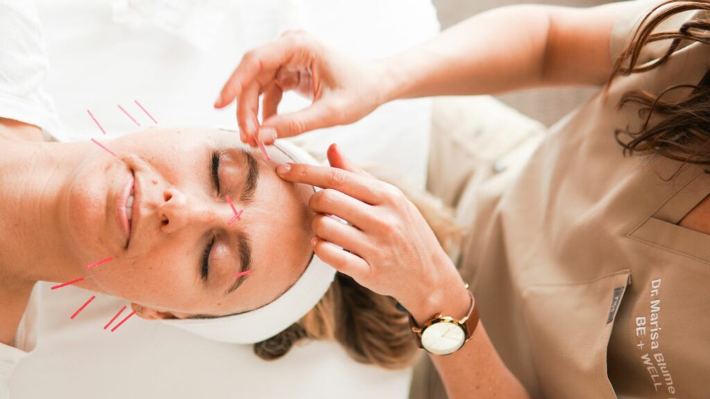Cosmetic Acupuncture and Microneedling